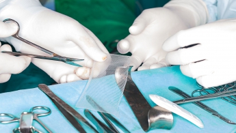 运用Parx技术的疝气网可减少腹壁修复手术中的感染